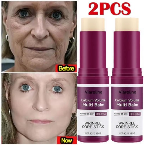 Stück calcium volume - 2,